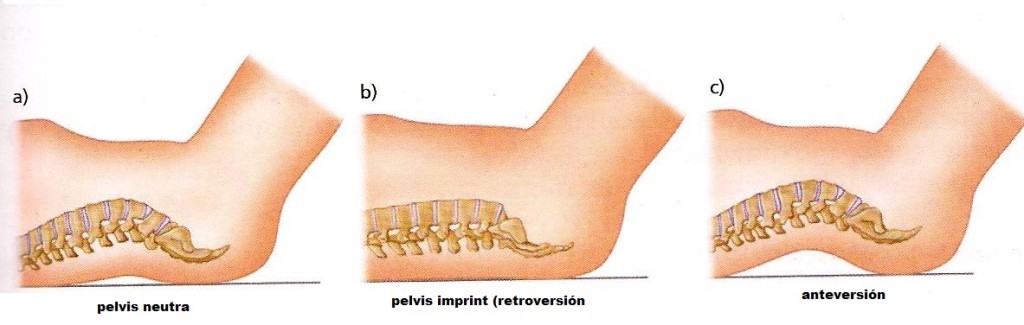 pilates imagen destacada